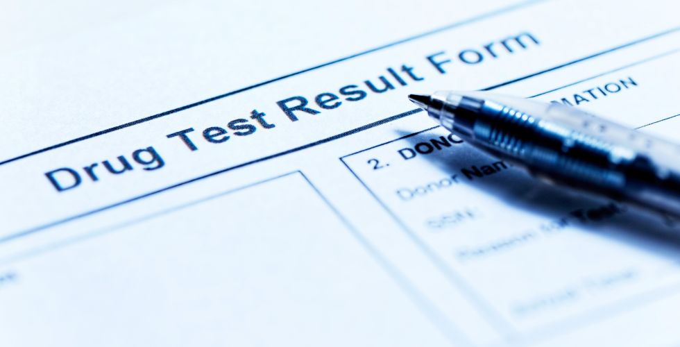 drug testing violate